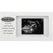 "Malden : 4\" X 6\" \"Sneak Peak Sonogram Plaque\" Picture frame - White at Annie's Hallmark"