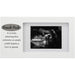 Malden : 4" X 6" "Sneak Peak Sonogram Plaque" Picture frame - White -